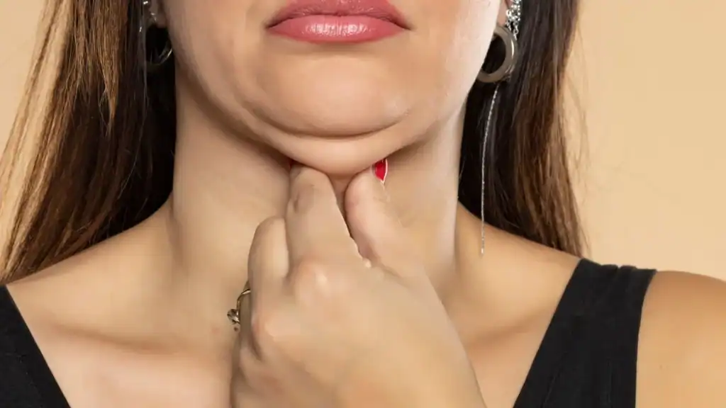 An image of a woman with double chin, sad, worried : Non Surgical Double Chin Removal Treatment in Corstorphine, UK