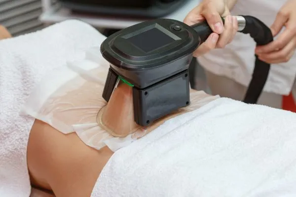 Image of person having fat freezing treatment to help weight gain Corstorphine