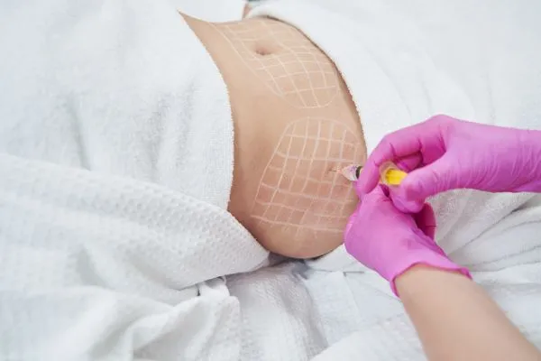 image of fat dissolving injections on love handles to help combat weight gain Corstorphine